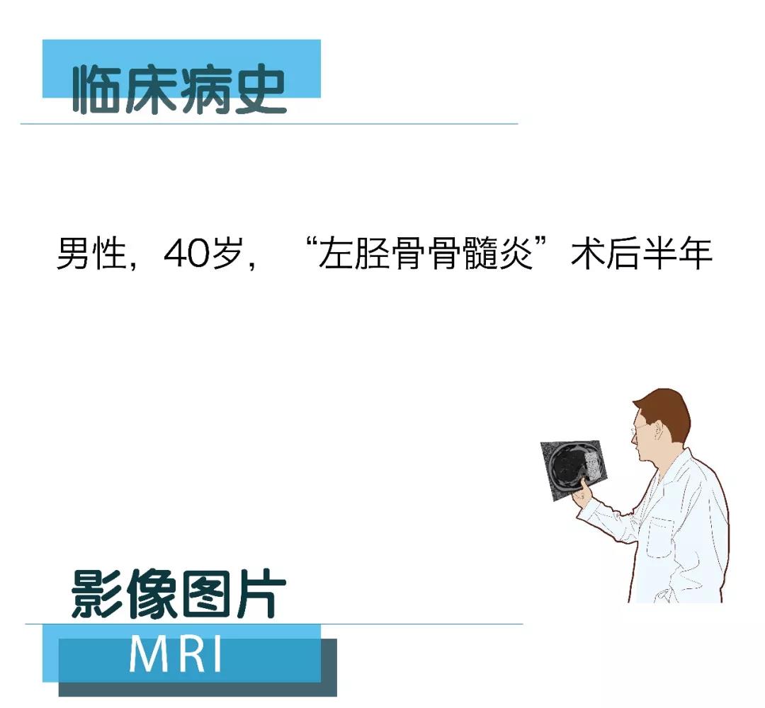 【朗潤影像檔案】磁共振影像病例分享（編號20180209）