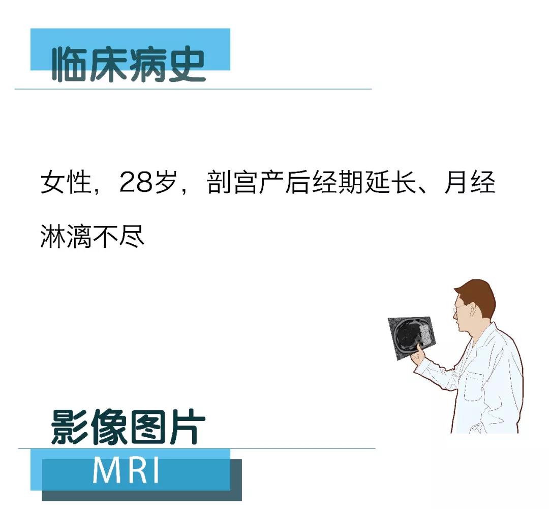 【朗潤影像檔案】磁共振影像病例分享（編號20180309）