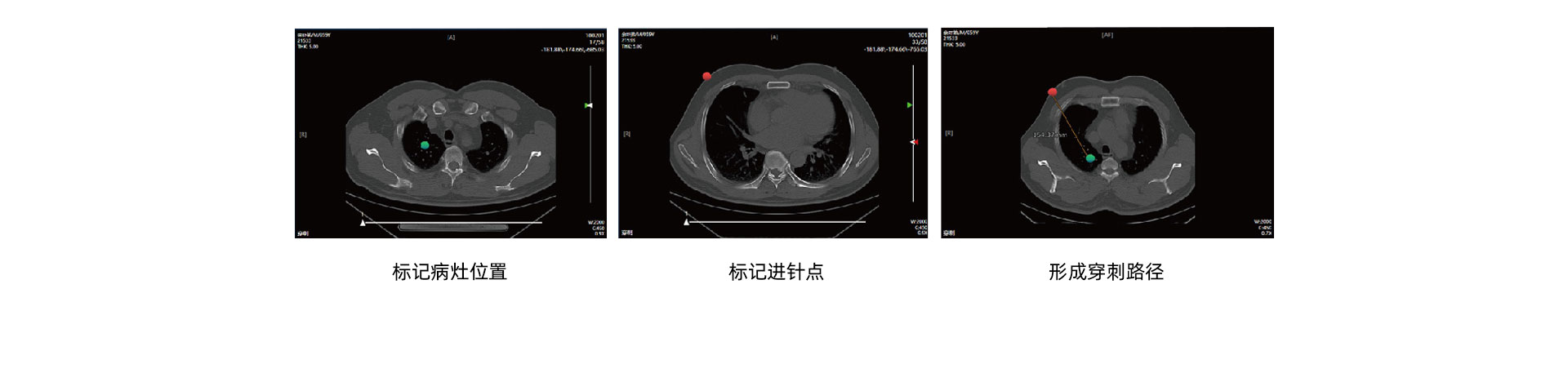 (影像介入)CT介入手術移動工作站_05.jpg